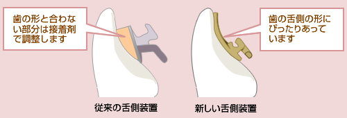 顎口腔機能の解析装置（ヘッドギア部分）